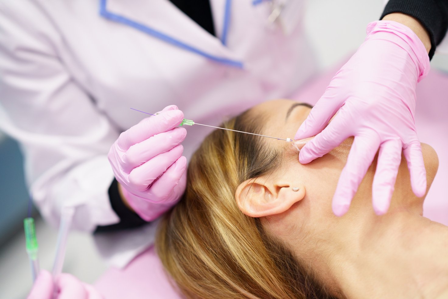 Doctor Injecting PDO Suture Threads Into Woman's Face