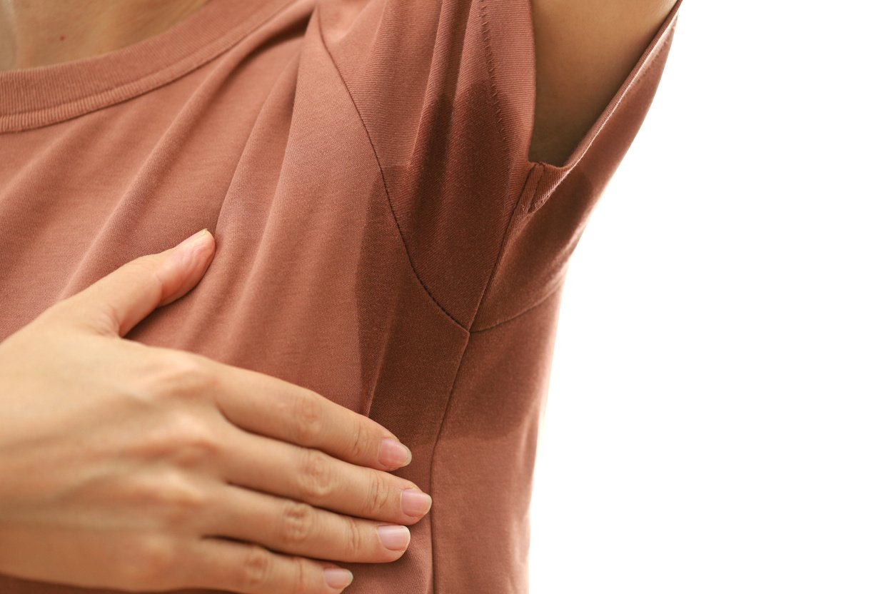 Close-up Asian woman with hyperhidrosis sweating.